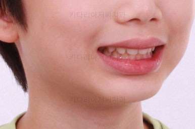 부산어린이교정