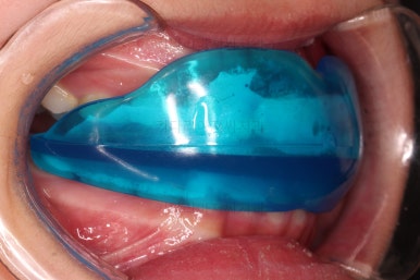 부산어린이교정