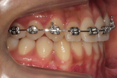 부산연산동청소년교정