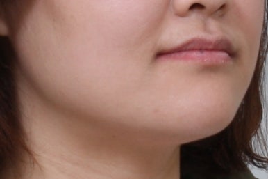 부산치아교정치과