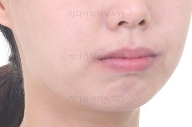 부산치아교정잘하는치과