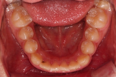 부산청소년교정