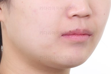 부산치아교정치과