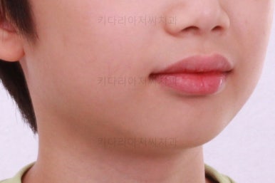 부산어린이교정