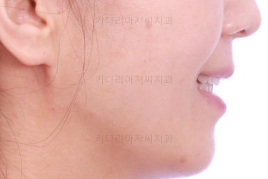 부산인비절라인