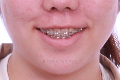 부산교정전문치과