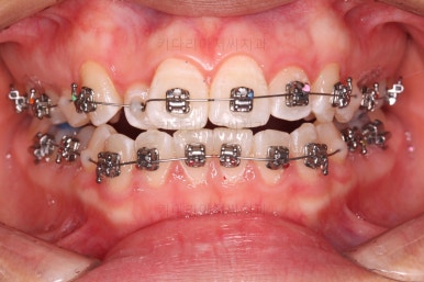 사직동교정치과