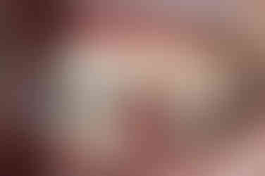 부산비수술교정