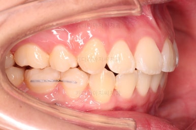 연산동치아교정치과