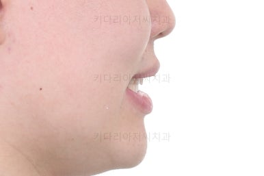 동래교정치과