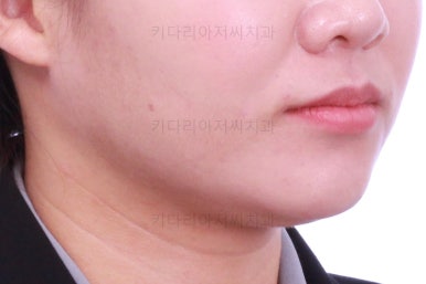 부산치아교정치과
