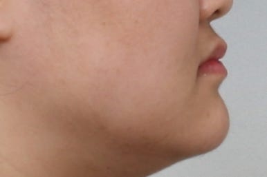 부산치아교정치과