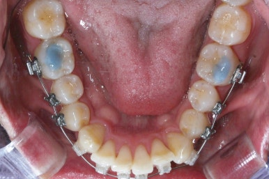 부산교정치과추천