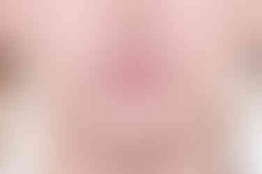 부산비대칭교정