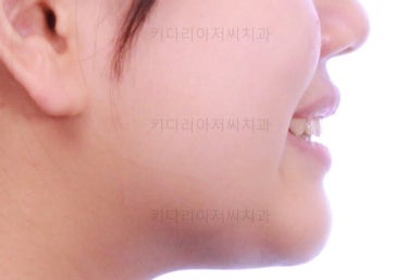 부산교정전문의