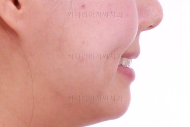 부산치아교정잘하는치과