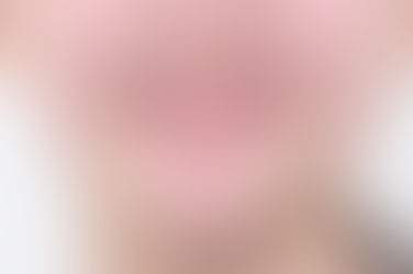 부산덧니교정