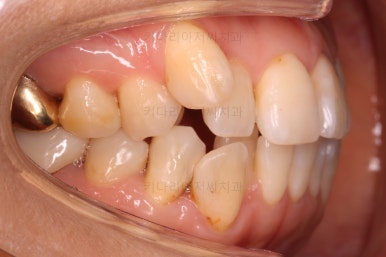 부산인비절라인