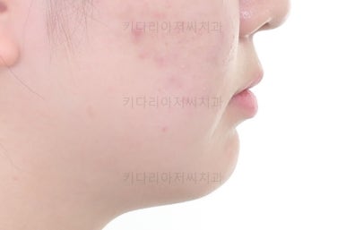 부산치아교정잘하는곳