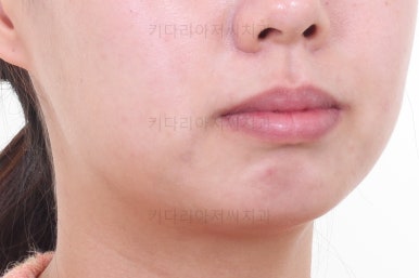 부산치아교정잘하는치과