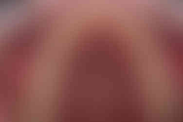 부산앞니부분교정