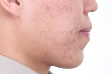 부산교정과전문의