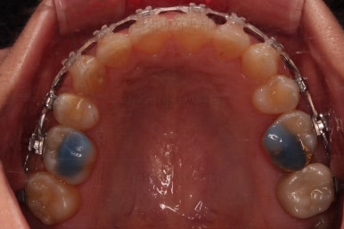 연산동교정치과