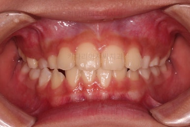 부산어린이교정