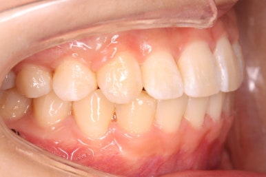 연산동교정치과