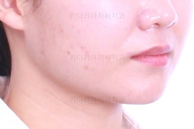 부산치아교정치과