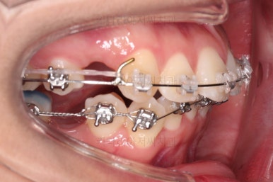 연산동치아교정치과