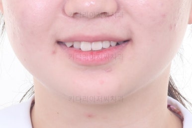 부산치아교정잘하는곳