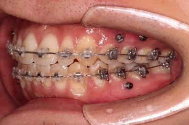 부산연제구교정