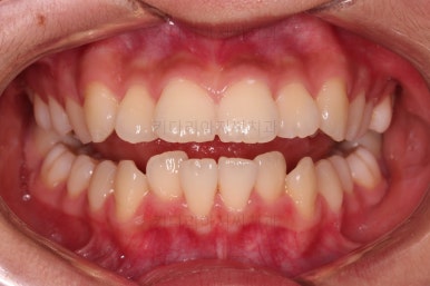 부산치아교정치과