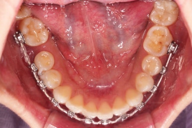 연산동교정치과