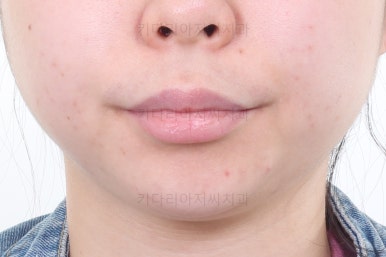 부산연산동교정치과