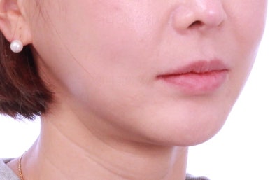 연산동부분교정