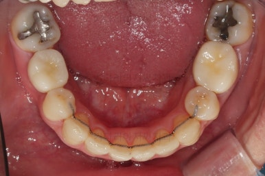 부산재교정치과