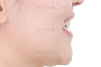 연산동교정치과