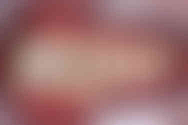 부산주걱턱교정