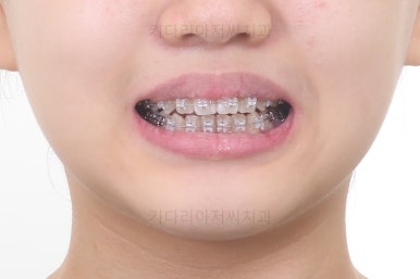 부산교정전문의