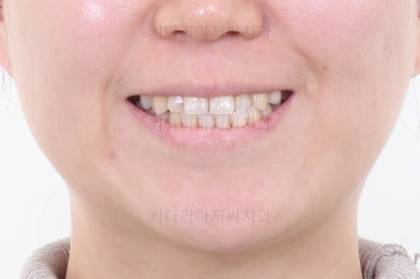 부산연산동치과