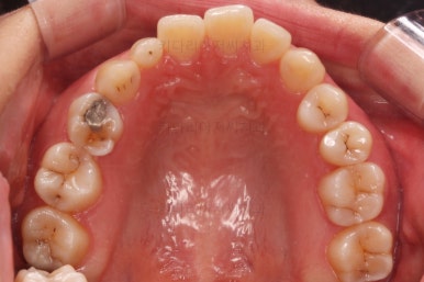 부산인비절라인