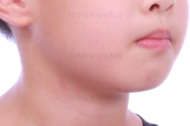 부산어린이교정