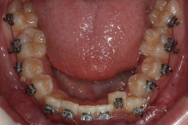 부산교정전문의