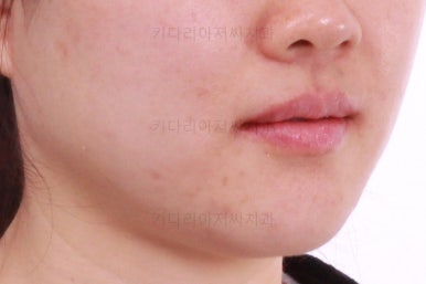 부산인비절라인