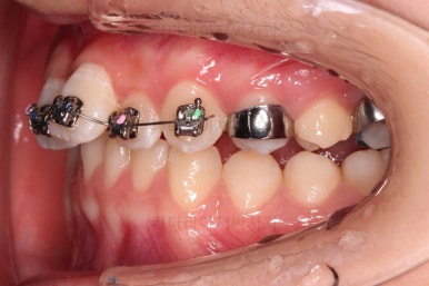 부산청소년교정치과