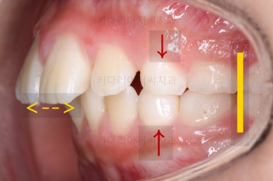 부산어린이교정