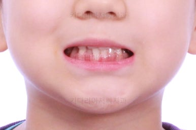 부산어린이교정