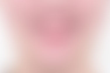 부산개방교합